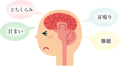 耳鳴り・めまい・立ちくらみはなぜ起こる
